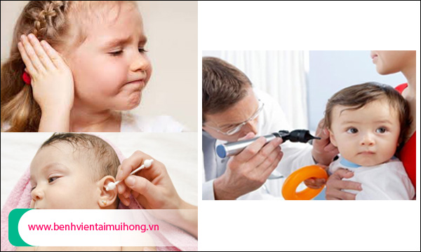 Bệnh viêm tai giữa ở trẻ sơ sinh