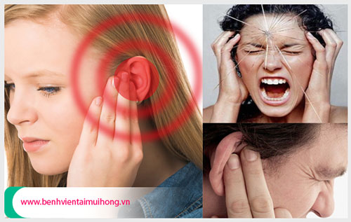 Bệnh viêm tai giữa thanh dịch là gì và cách chữa trị hiệu quả
