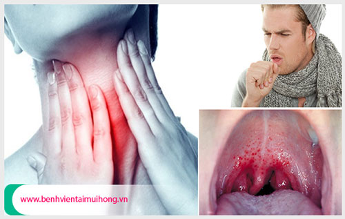 Bệnh viêm họng hạt mãn tính có chữa được không?