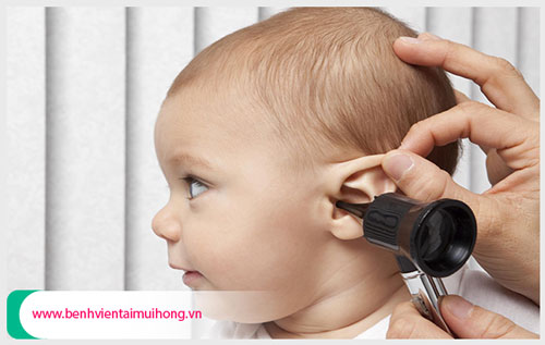 Bệnh viêm tai giữa ở trẻ sơ sinh