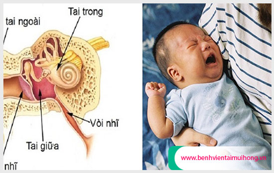 Nguyên nhân dẫn đến bệnh viêm tai giữa ở trẻ sơ sinh