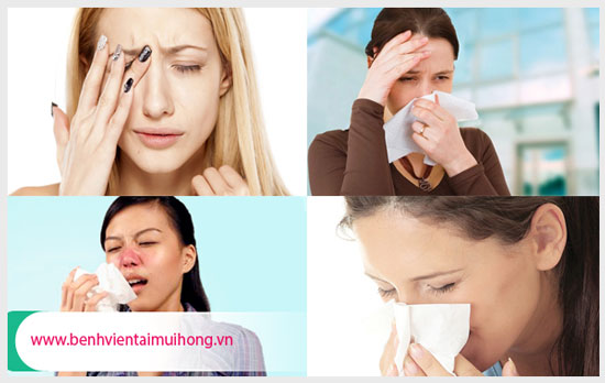 Những biểu hiện đặc trưng của viêm xoang mũi