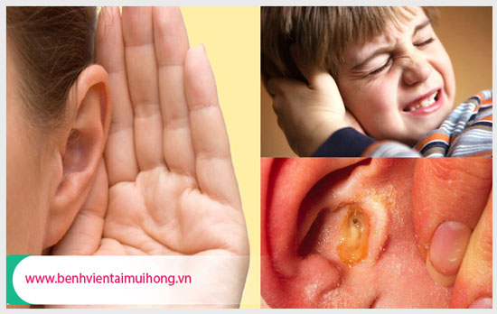 Các triệu chứng điển hình của bệnh viêm tai giữa