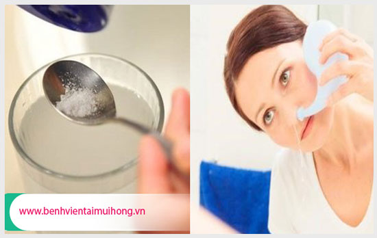 Hướng dẫn cách chữa viêm mũi với nước muối