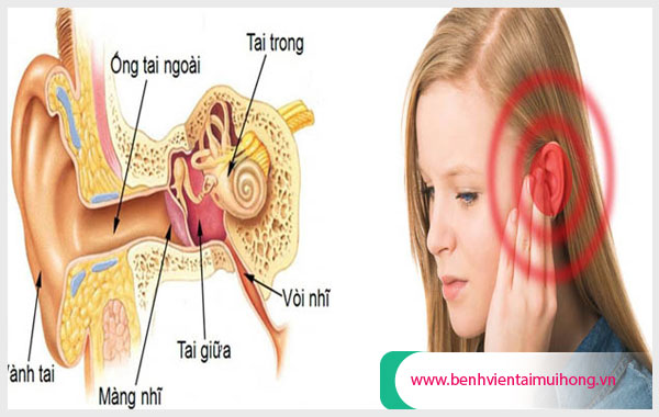 Bệnh viêm tai giữa - cần điều trị sớm để tránh bị điếc tai vĩnh viễn