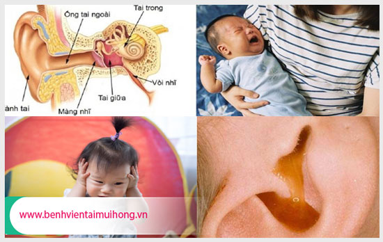 Những điều cần biết về bệnh viêm tai giữa ở trẻ