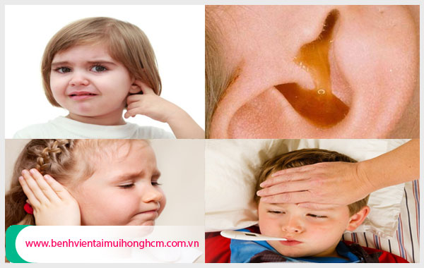 Bệnh viêm tai giữa ở trẻ em cần phát hiện và điều trị kịp thời