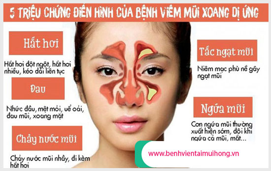 Những biểu hiện điển hình nhất khi bị viêm mũi dị ứng
