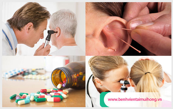 Phương pháp điều trị điếc tai hiệu quả nhất