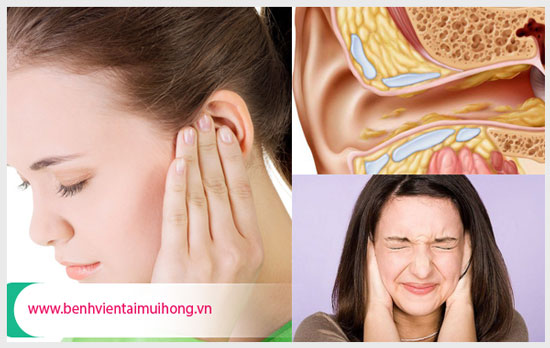 Nguyên nhân và biến chứng của viêm tai giữa