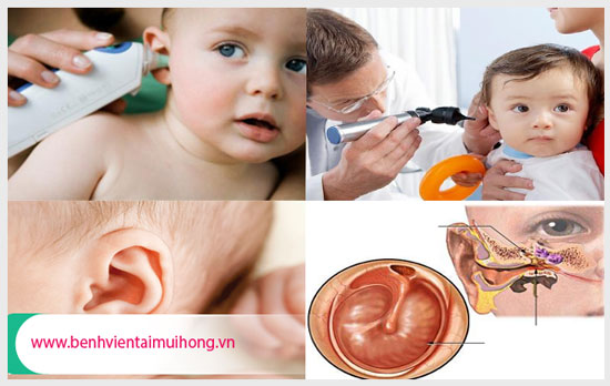 Thăm khám và điều trị viêm tai giữa ở trẻ sơ sinh