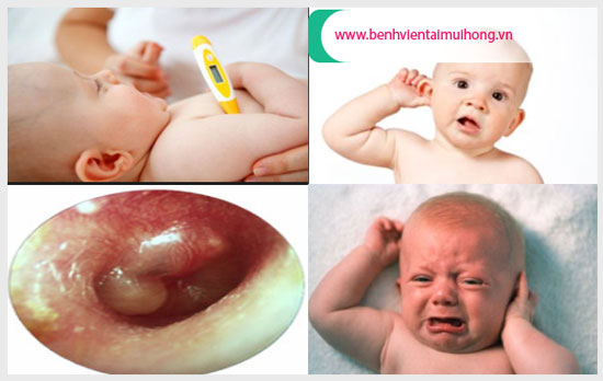Kịp thời phát hiện dấu hiệu viêm tai giữa ở trẻ sơ sinh