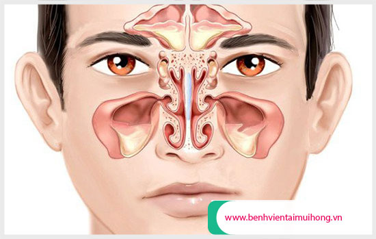 Nghẹt mũi khó thở là bị gì? Cách chữa trị?