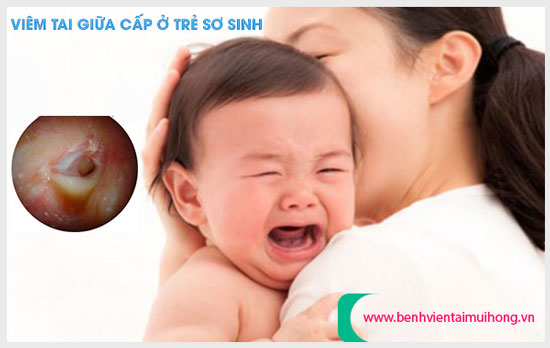 Nguyên nhân gây viêm tai giữa cấp ở trẻ sơ sinh cha mẹ cần biết