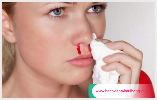 Nguyên nhân thường gặp gây chảy máu mũi và cách xử lý