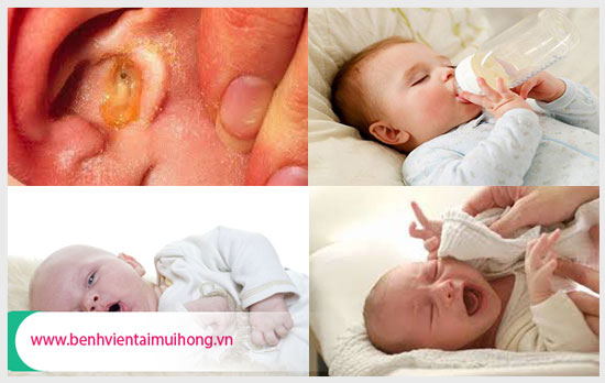 Nguyên nhân trẻ sơ sinh bị viêm tai giữa