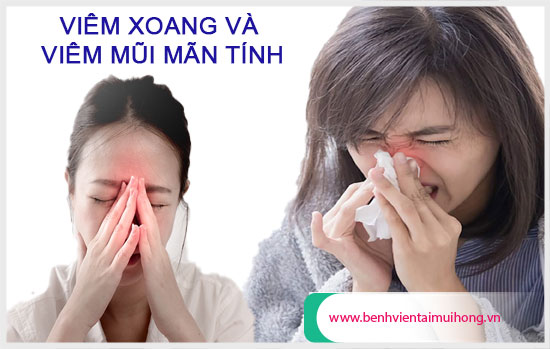 Phân biệt viêm xoang và viêm mũi mãn tính Phan-biet-viem-xoang-va-viem-mui-man-tinh-va-huong-dan-dieu-tri