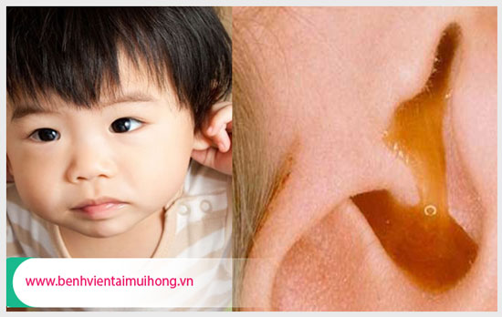 Trẻ bị viêm tai giữa có gây ra nguy hiểm không?