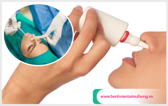 Sức khỏe, đời sống: điều trị vẹo vách ngăn mũi để tránh ảnh hưởng đến cuộc sống Veo-vach-ngan-mui-anh-huong-den-cuoc-song-sinh-hoat-nhu-the-nao3