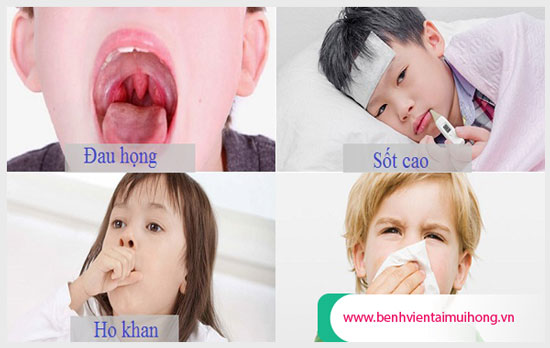 Triệu chứng đặc trưng của viêm họng