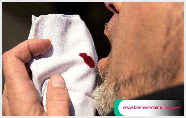 Viêm họng chảy máu có thể cảnh báo nguy cơ ung thư vòm họng