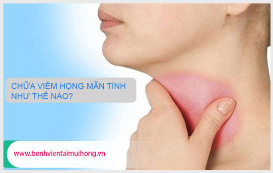 Triệu chứng của bệnh viêm họng mãn tính