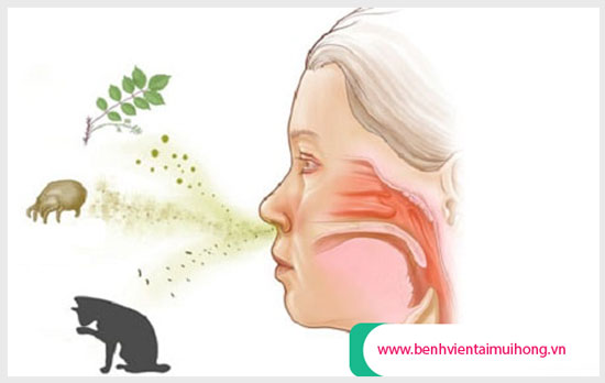 Nguyên nhân gây viêm mũi vận mạch