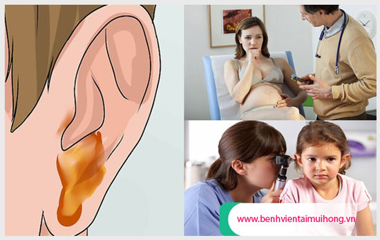 Phương pháp chữa viêm tai giữa cấp xuất tiết
